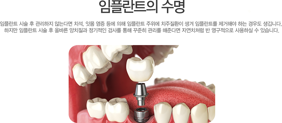 öƮ 
  öƮ ü   ʴ´ٸ ġ, ո    öƮ  ġȯ  öƮ ؾ ϴ 쵵 ϴ. 
 öƮ ü  ùٸ ġ  ˻縦    شٸ ڿġó   Ͻ  ֽϴ.
